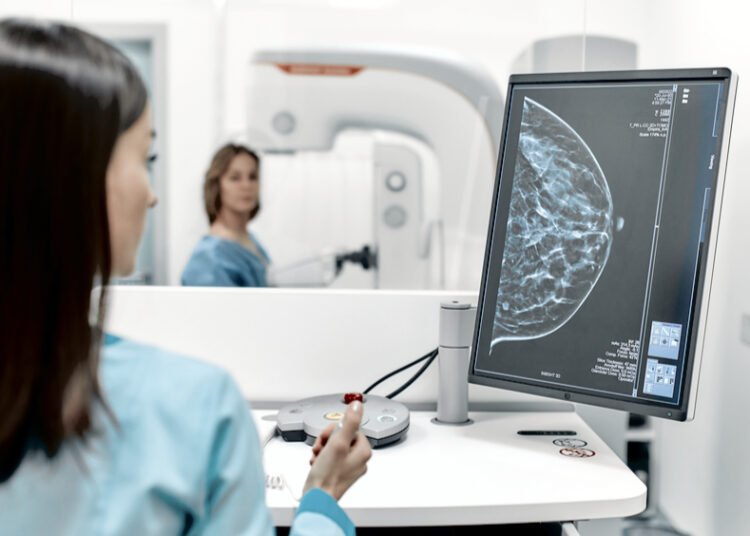 La IA reduce a la mitad los tiempos de un estudio médico fundamental para las mujeres