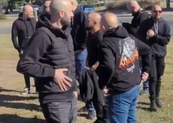Sin complejos ni implantes: Crece el fenómeno del “orgullo pelado” en Argentina