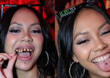 Se puso dientes podridos para salir a bailar y el insólito motivo hizo estallar las redes sociales